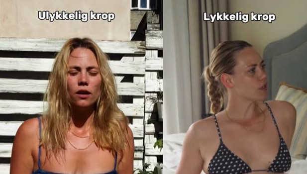 Dansk influencer åbner op om teenageår med spiseforstyrrelse: ’Startede med én kommentar’