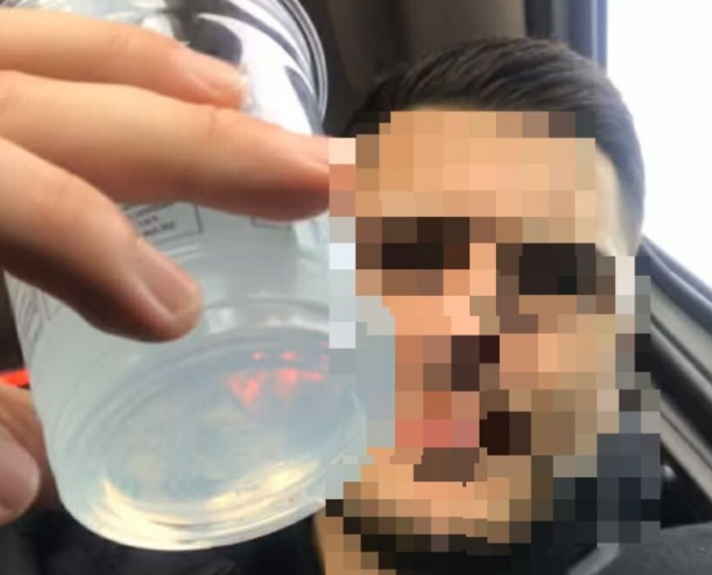 Advarsel om ekstrem voldsomhed: ‘Der løber gul væske ud af hans hjerne’